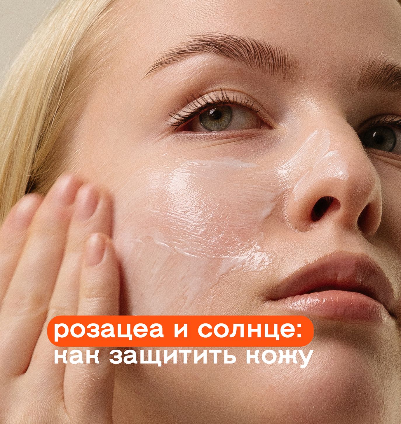Розацеа летом: как избежать обострений