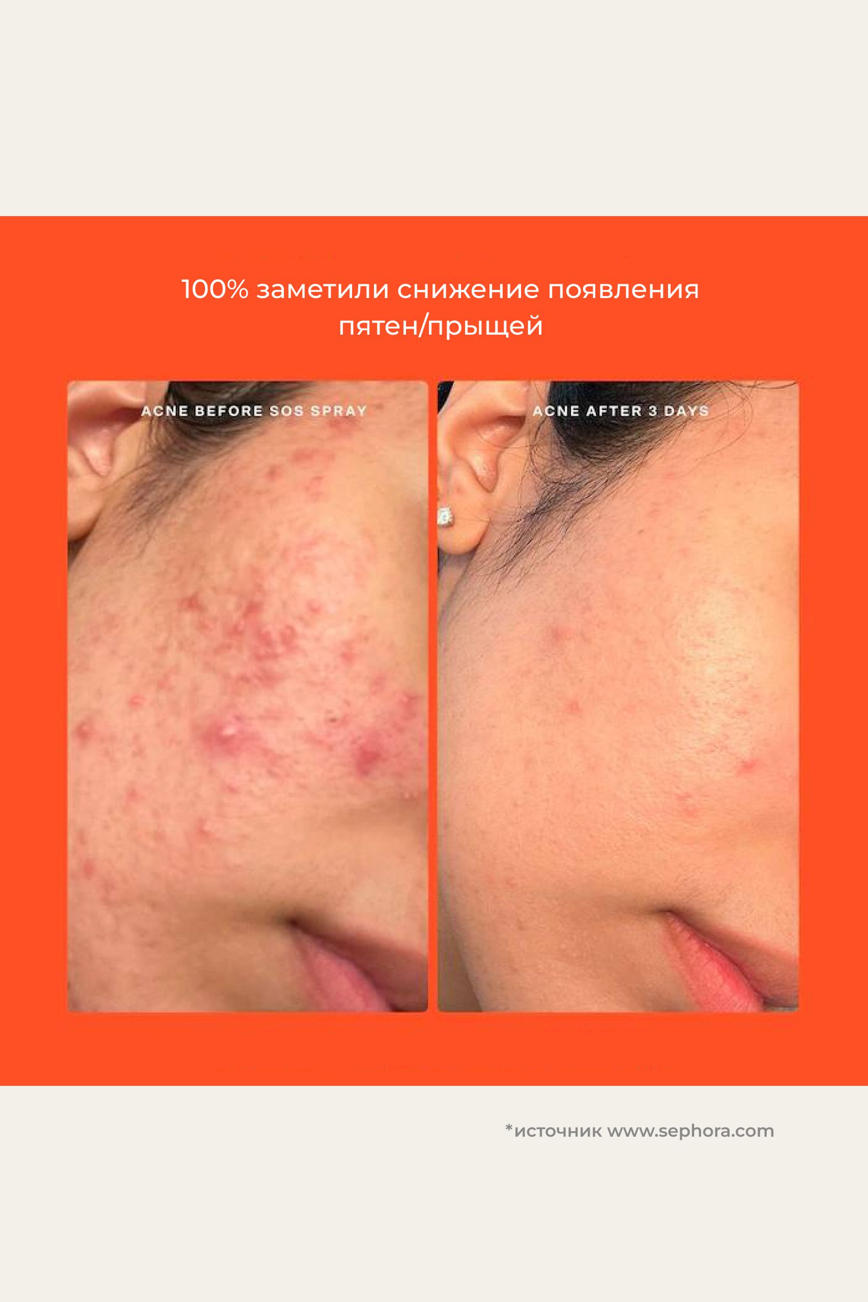 

Мини-набор бестселлеров Tower 28 Beauty Mini SOS Set 15ml/30ml/20ml