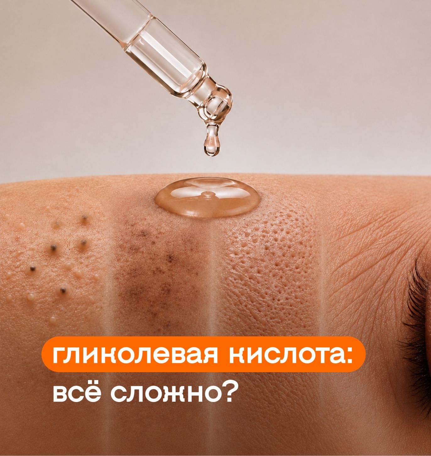 Гликолевая кислота: как подружить её с кожей?
